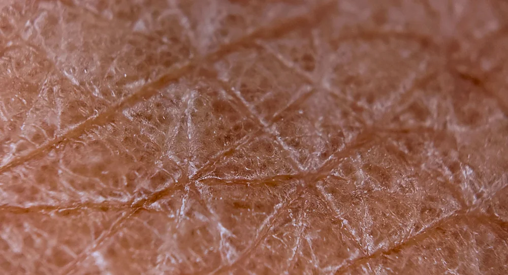 A close-up of dull skin with fine lines that BroadBand Light (BBL) brightens and smooths, at a Thonotosassa, FL medical spa
