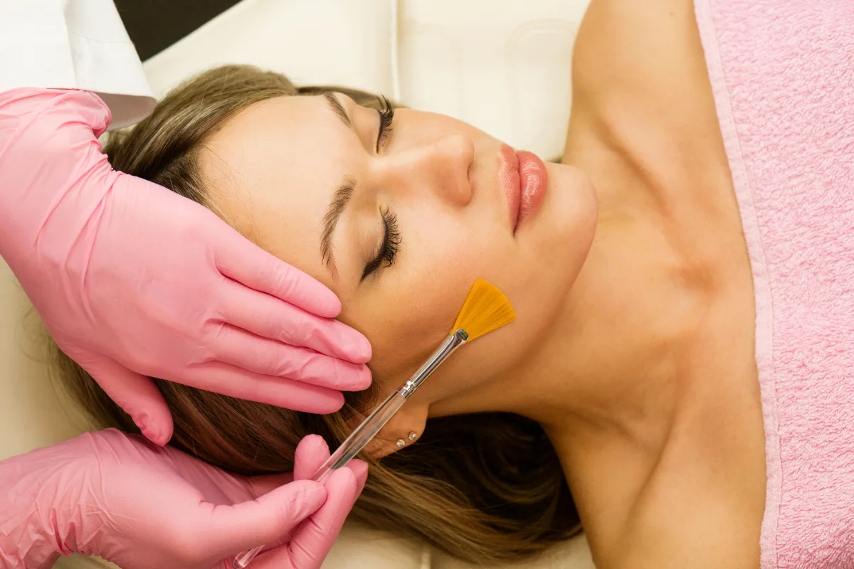 BioRePeel chemical peel application at a Thonotosassa medical spa