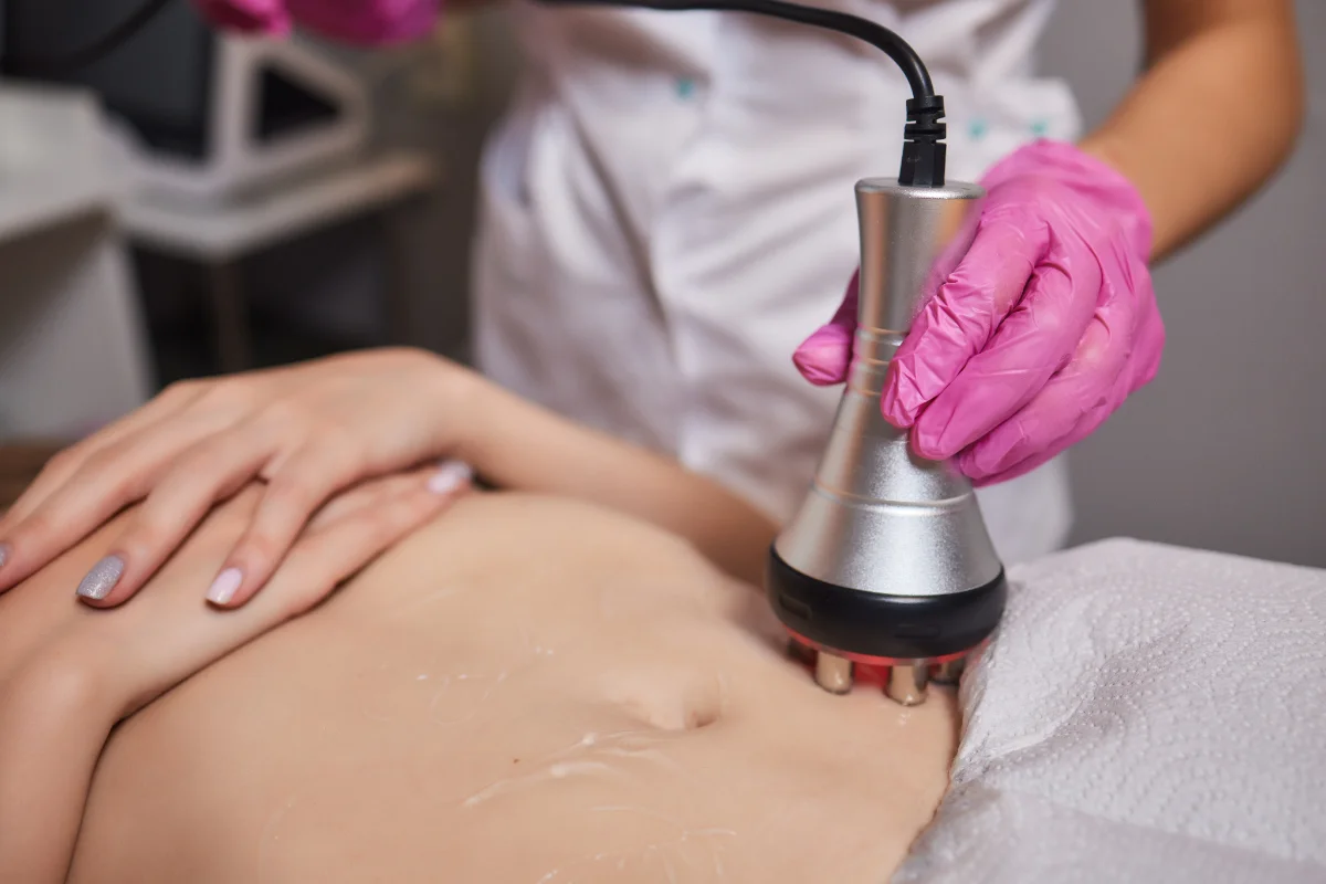 Non-surgical body contouring radiofrequency treatment at a Thonotosassa medical spa