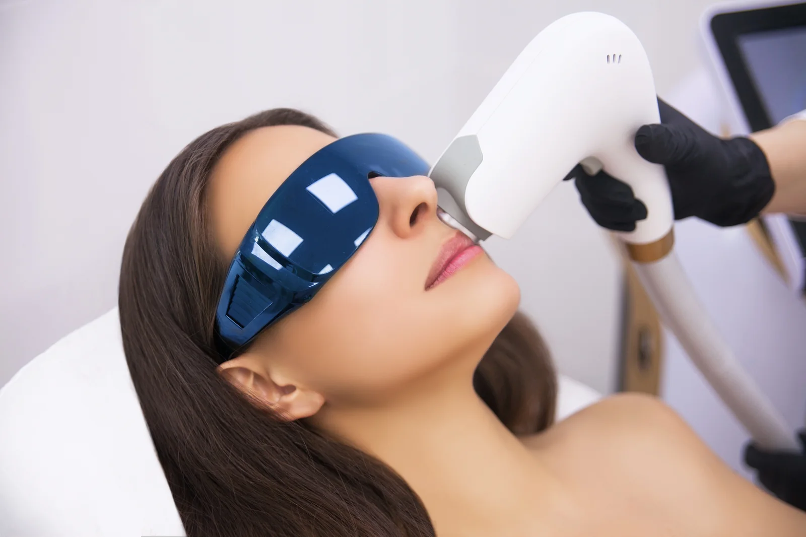 A BroadBand Light BBL photofacial in progress with protective eyewear at SpaRx Medical Aesthetics in Thonotosassa, FL