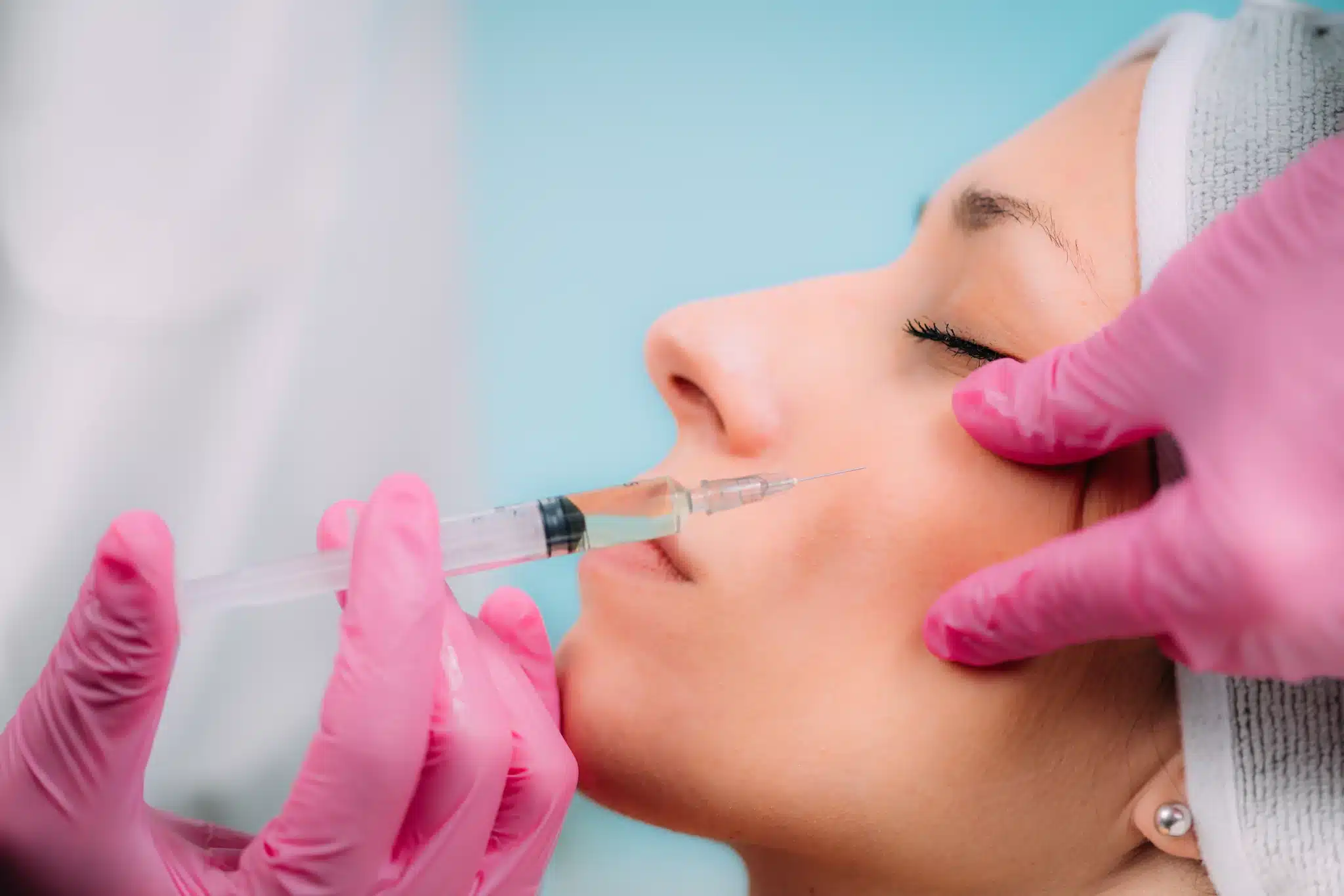 A dermal filler treatment in progress, with a certified injector placing hyaluronic acid filler at SpaRx Medical Aesthetics in Thonotosassa, FL.