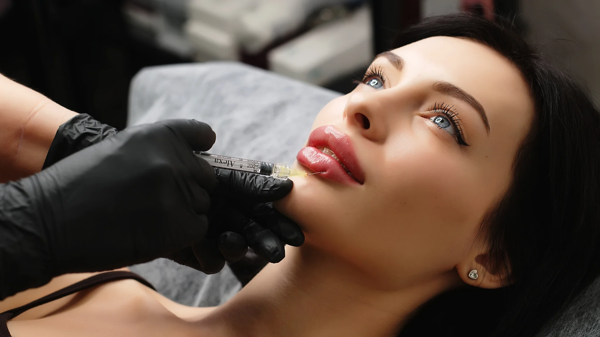 A certified injector performing a hyaluronidase filler-dissolving treatment on a patient's lips at SpaRx Medical Aesthetics in Thonotosassa, FL.
