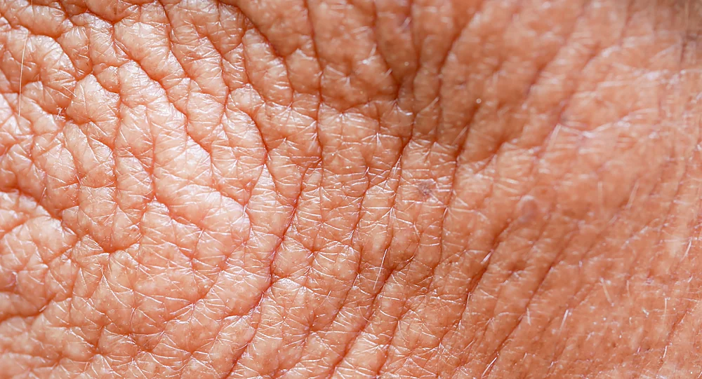 A close-up of dull, dehydrated skin that a Deep Cleaning Hydro Facial hydrates and revives, at a Thonotosassa, FL medical spa