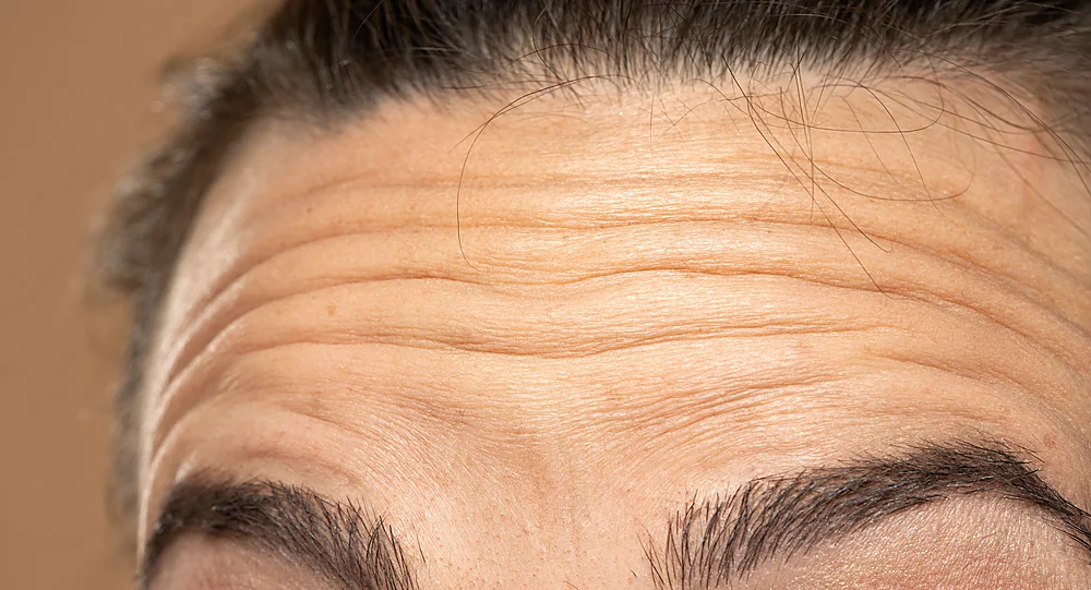 A close-up of fine lines that LED light therapy helps soften, at a Thonotosassa, FL medical spa