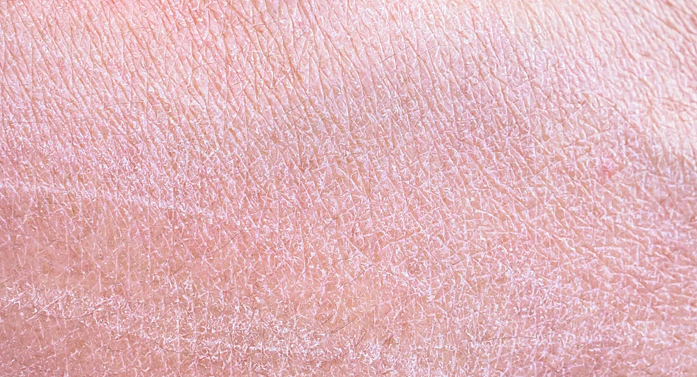A close-up of dull, tired-looking skin that LED light therapy helps refresh, at a Thonotosassa, FL medical spa