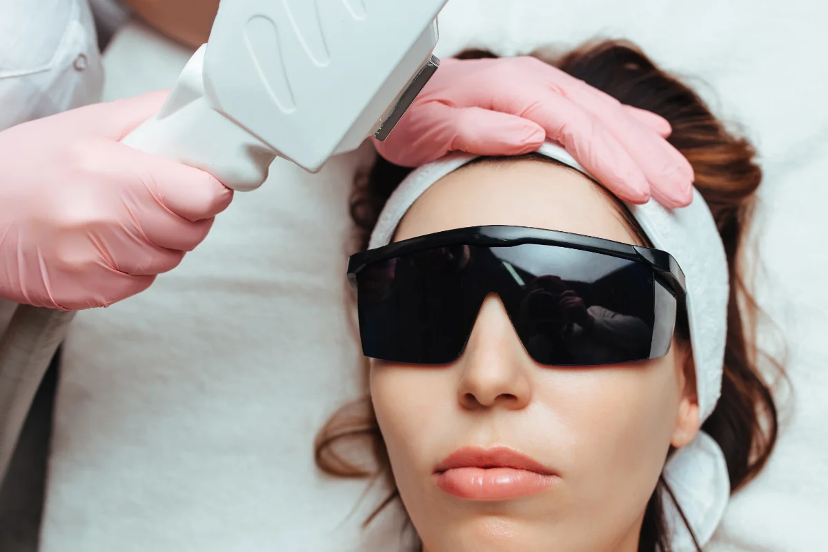 IPL photofacial light treatment for sun damage at a Thonotosassa med spa