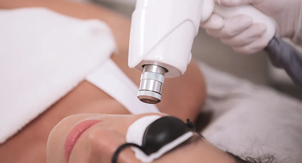 Laser hair removal on the upper lip at a Thonotosassa, FL medical spa