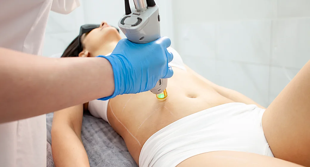 Full-body laser hair removal plan at a Thonotosassa, FL medical spa