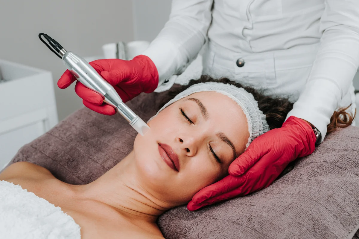 Microneedling collagen-induction facial at a Thonotosassa medical spa
