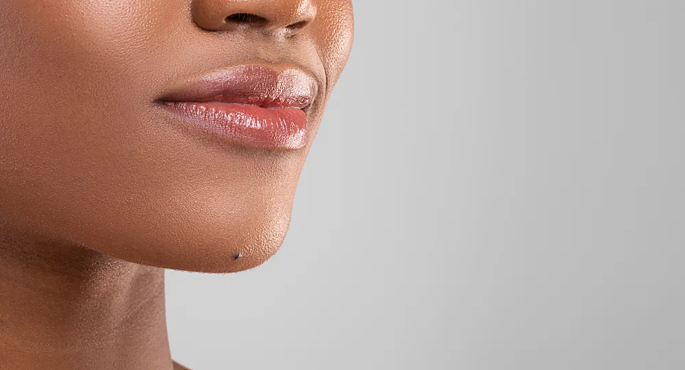A close-up of facial redness and visible vessels that Moveo Glo laser treatment calms, at a Thonotosassa, FL medical spa