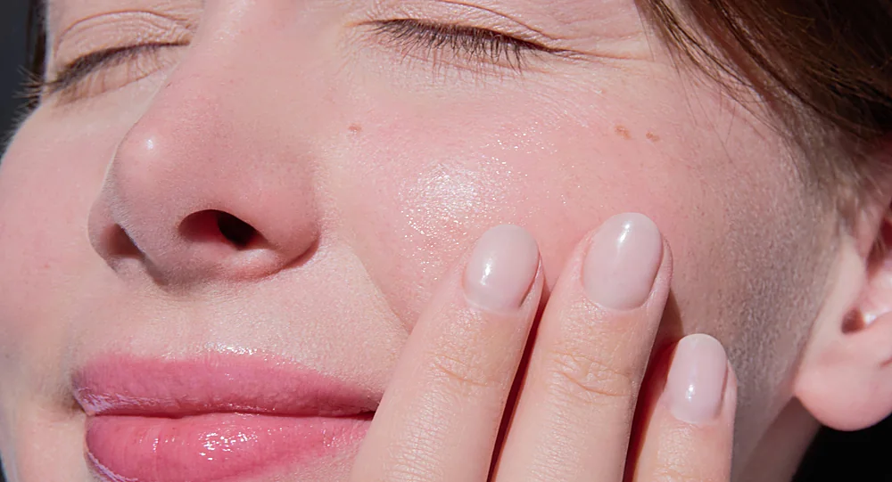 A close-up of skin with sun spots and uneven pigment that Moveo Glo laser skin rejuvenation targets, at a Thonotosassa, FL medical spa