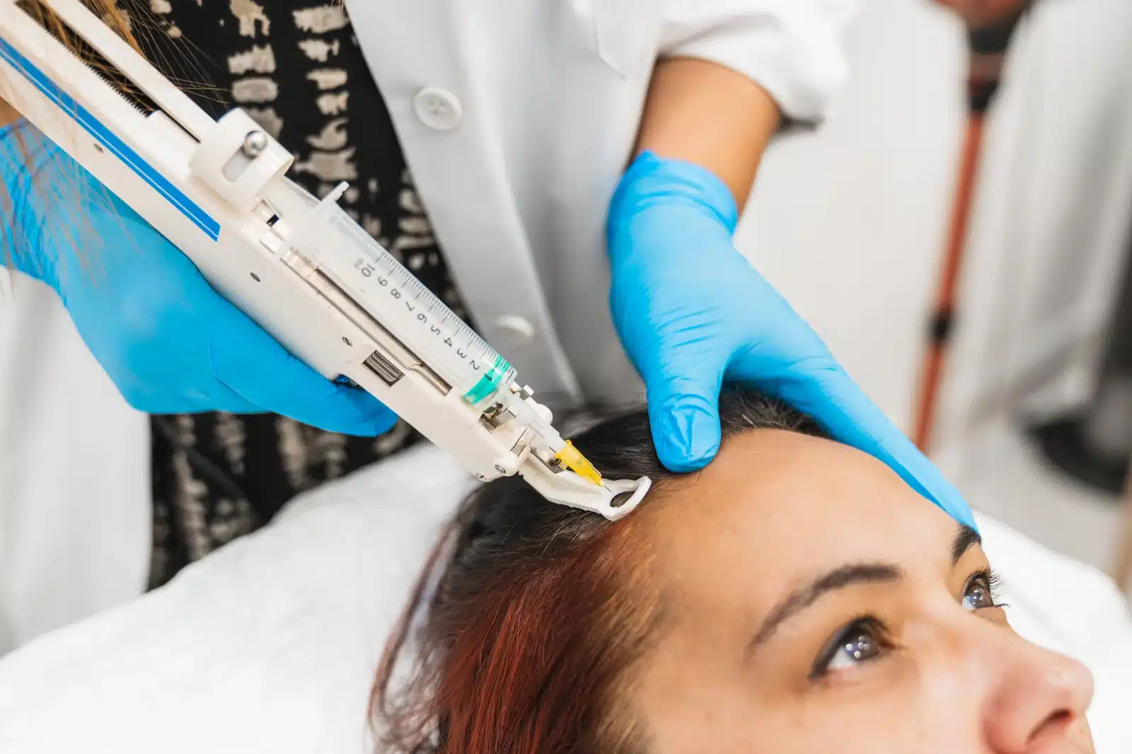 A certified injector applying platelet-rich plasma during a PRP treatment at SpaRx Medical Aesthetics in Thonotosassa, FL