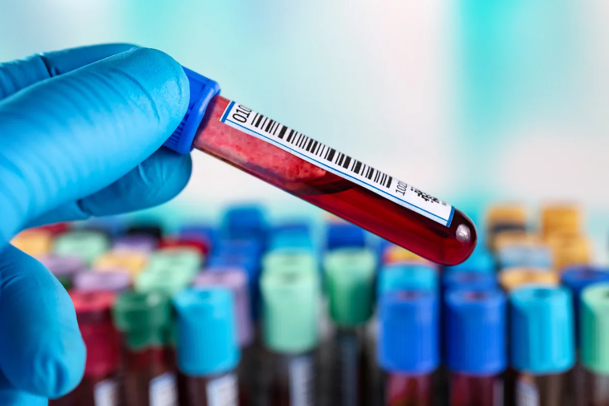 Blood sample prepared for a PRP and PRF regenerative treatment at a Thonotosassa med spa