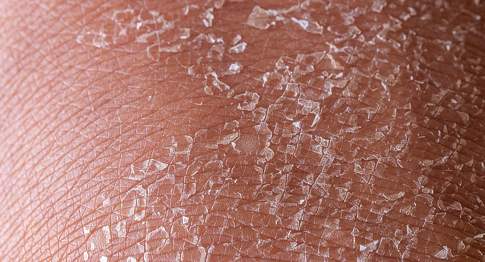 A close-up of dry, dehydrated skin that a SpaRx Signature Facial hydrates, at a Thonotosassa, FL medical spa