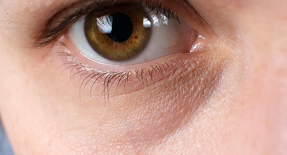 A close-up of dull, tired skin that a SpaRx Signature Facial refreshes and brightens, at a Thonotosassa, FL medical spa