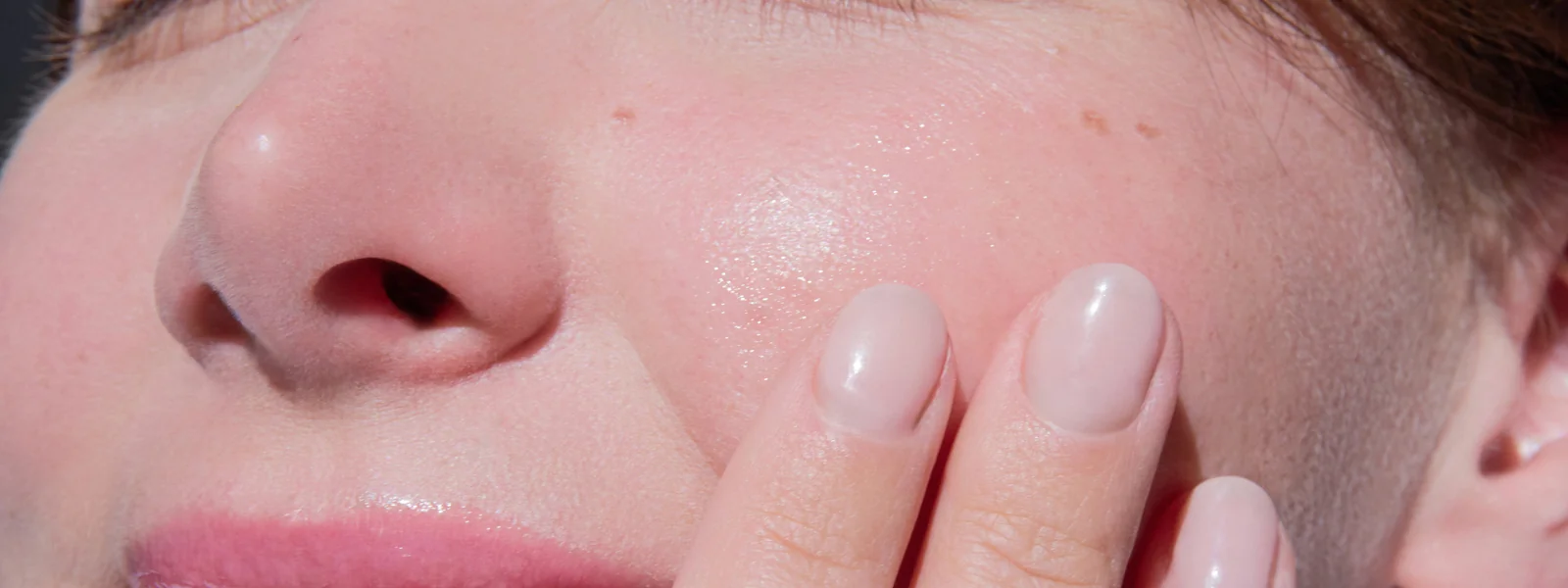 Smooth, even, healthy-looking skin after a course of microneedling at SpaRx Medical Aesthetics in Thonotosassa, FL.